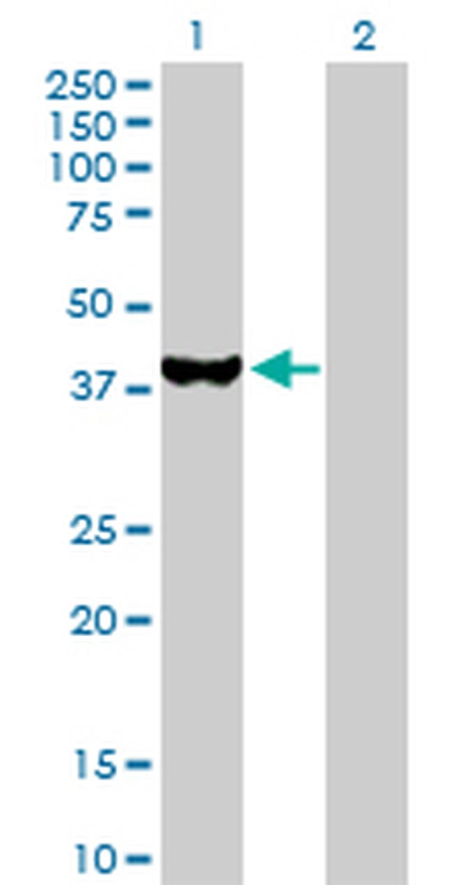 UROD Antibody in Western Blot (WB)