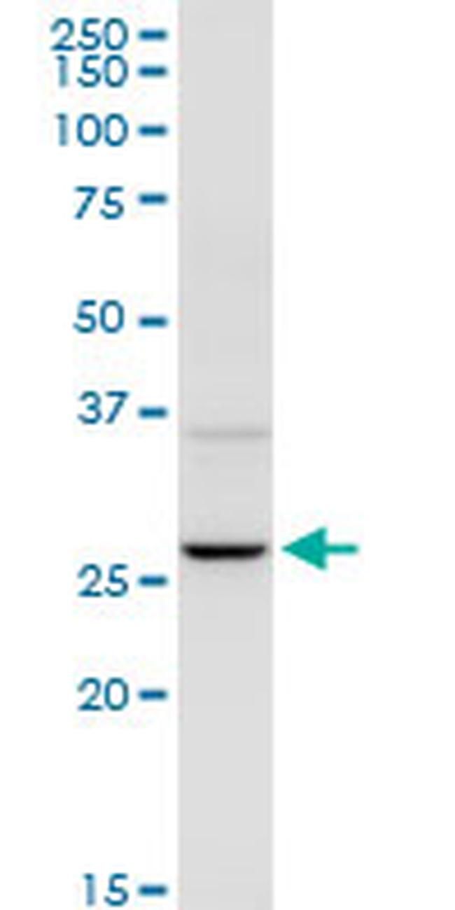 UROS Antibody in Western Blot (WB)