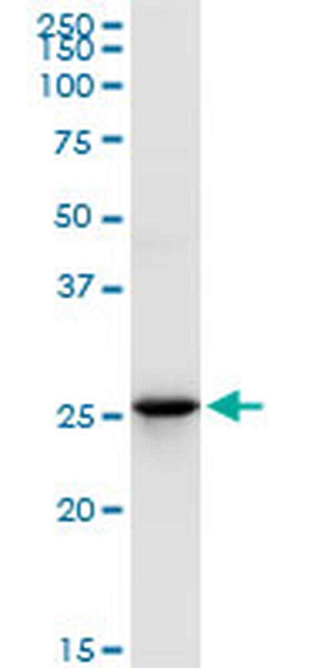 UROS Antibody in Western Blot (WB)