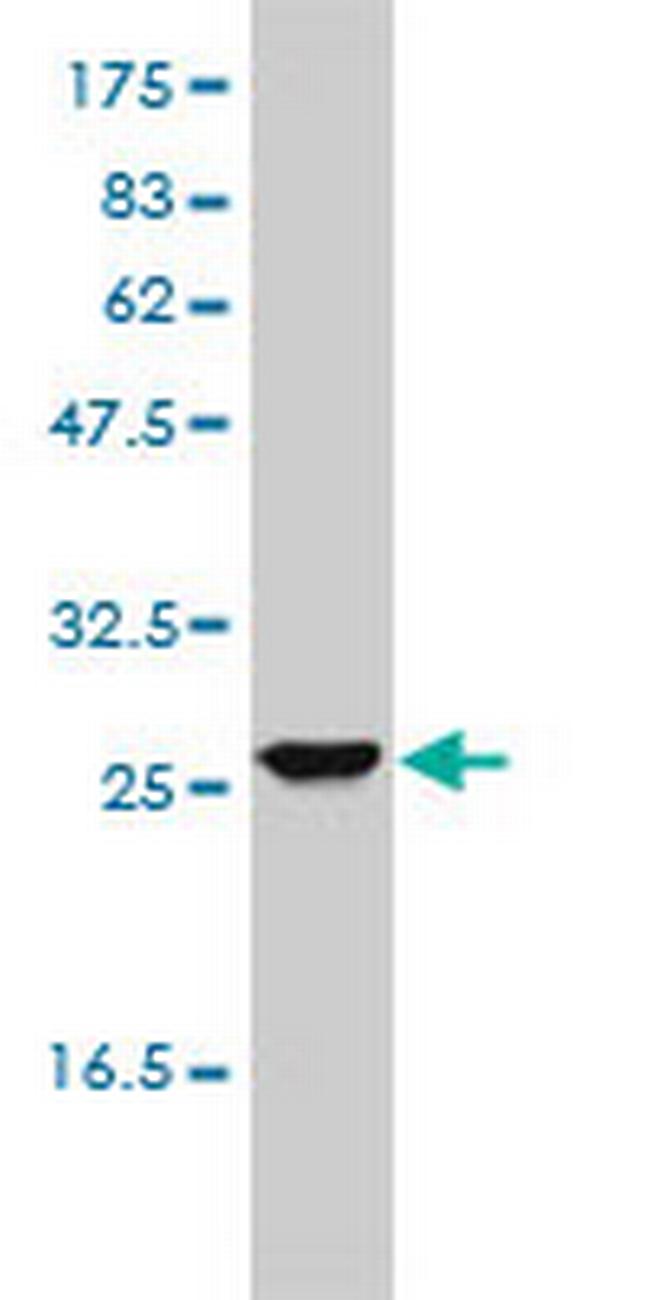 UROS Antibody in Western Blot (WB)