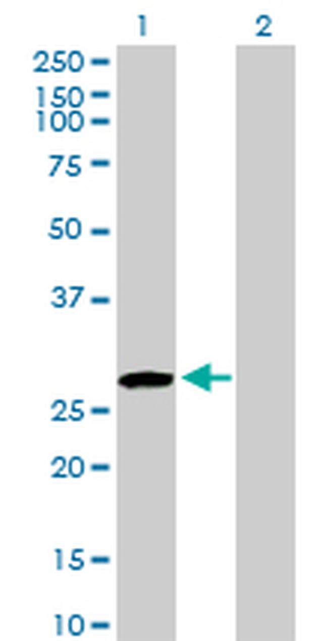 USF1 Antibody in Western Blot (WB)