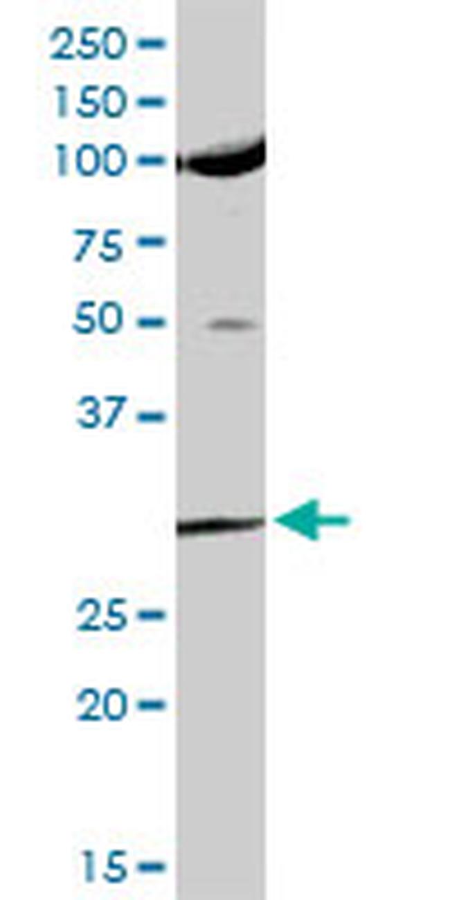 USF1 Antibody in Western Blot (WB)