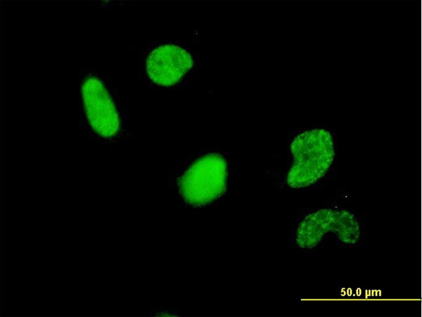 USF2 Antibody in Immunocytochemistry (ICC/IF)