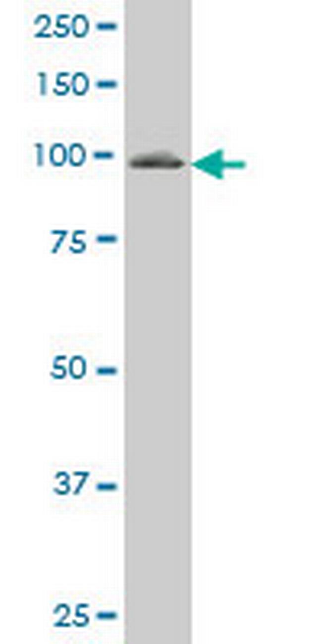 VAV1 Antibody in Western Blot (WB)