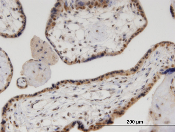 VCP Antibody in Immunohistochemistry (Paraffin) (IHC (P))