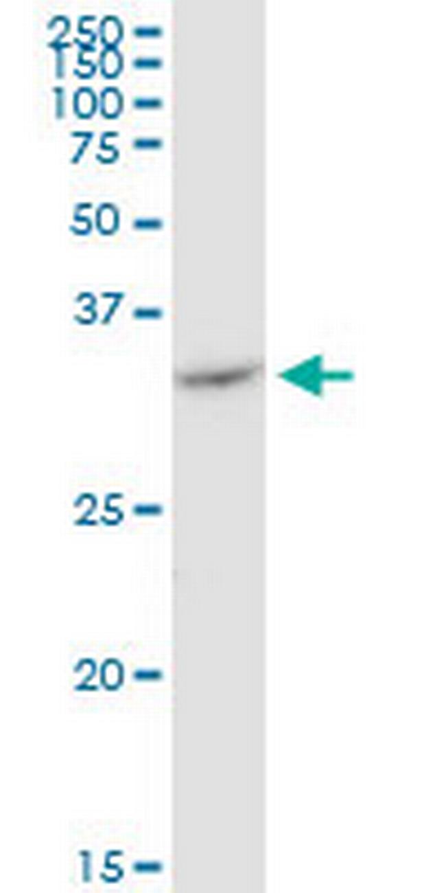 VDAC2 Antibody in Western Blot (WB)