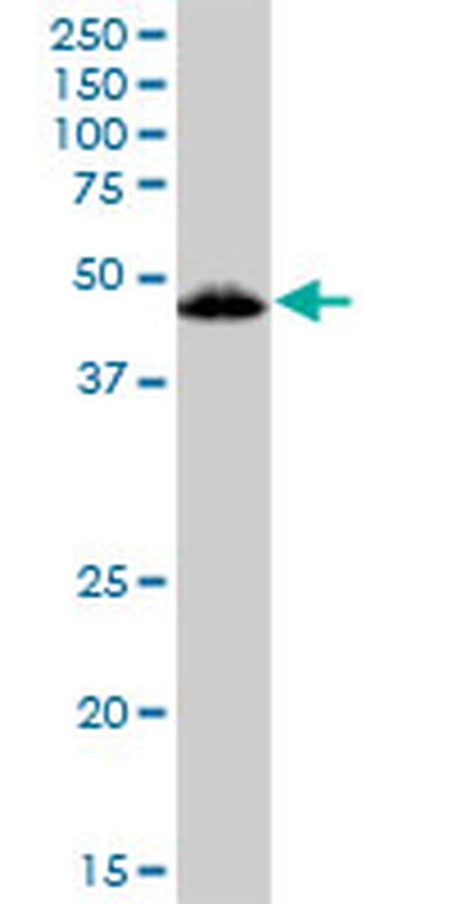 VDR Antibody in Western Blot (WB)