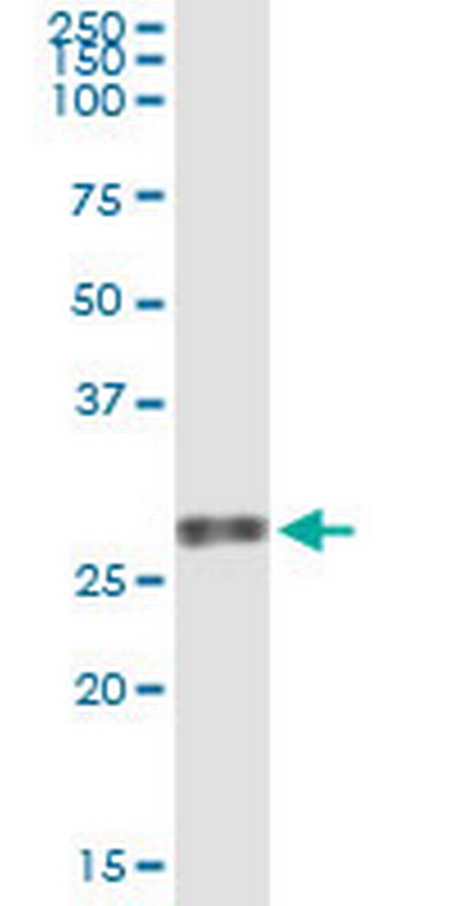 VEGFB Antibody in Immunoprecipitation (IP)