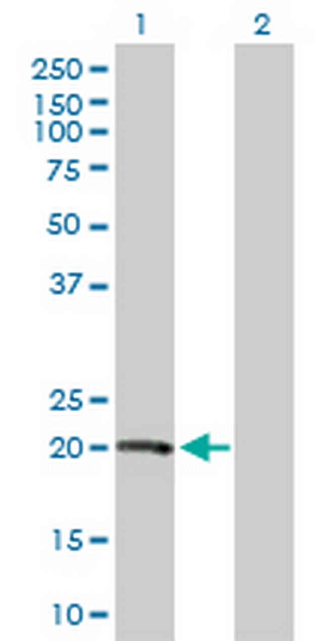 VHL Antibody in Western Blot (WB)