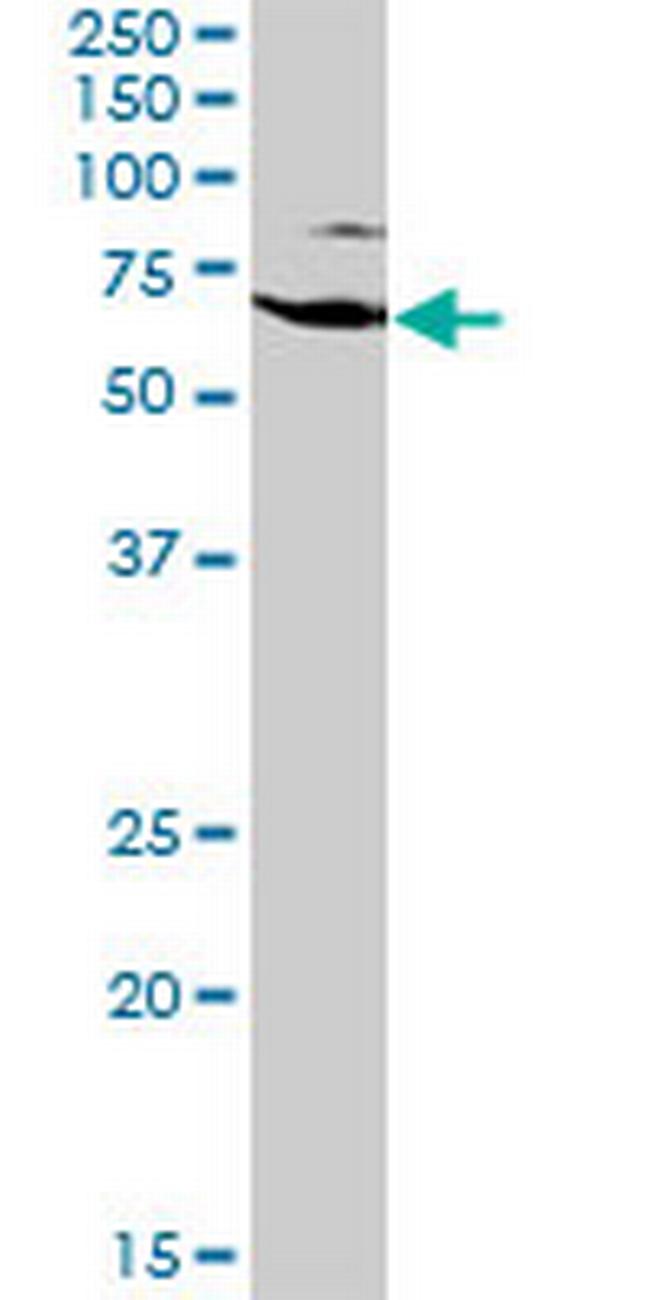 EZR Antibody in Western Blot (WB)