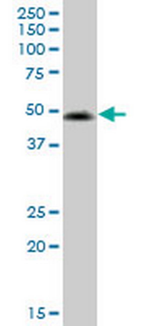 VIPR2 Antibody in Western Blot (WB)