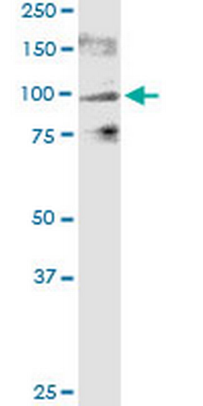 TRPV1 Antibody in Western Blot (WB)