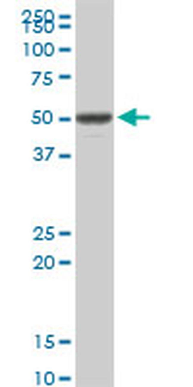 VRK1 Antibody in Western Blot (WB)