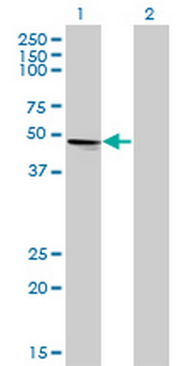 VRK1 Antibody in Western Blot (WB)