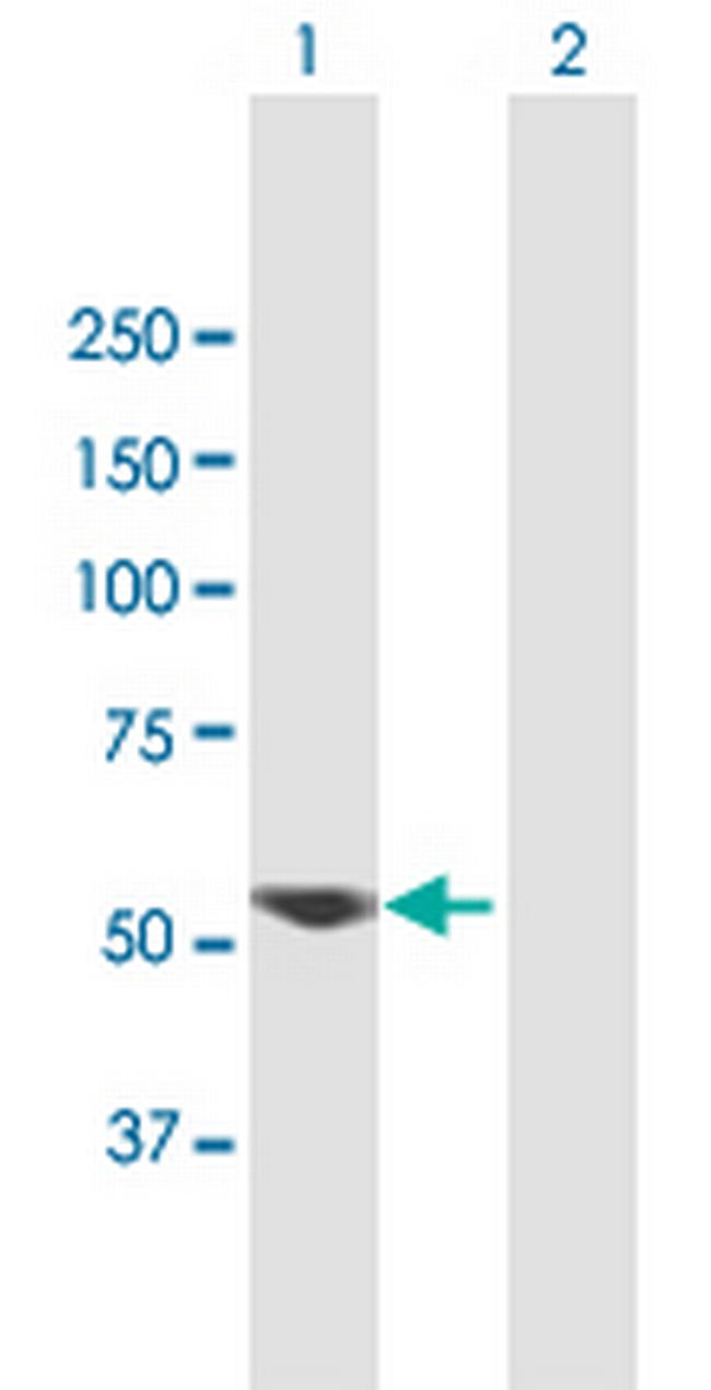 VRK2 Antibody in Western Blot (WB)