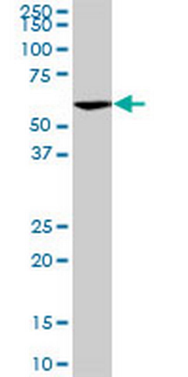 VRK2 Antibody in Western Blot (WB)