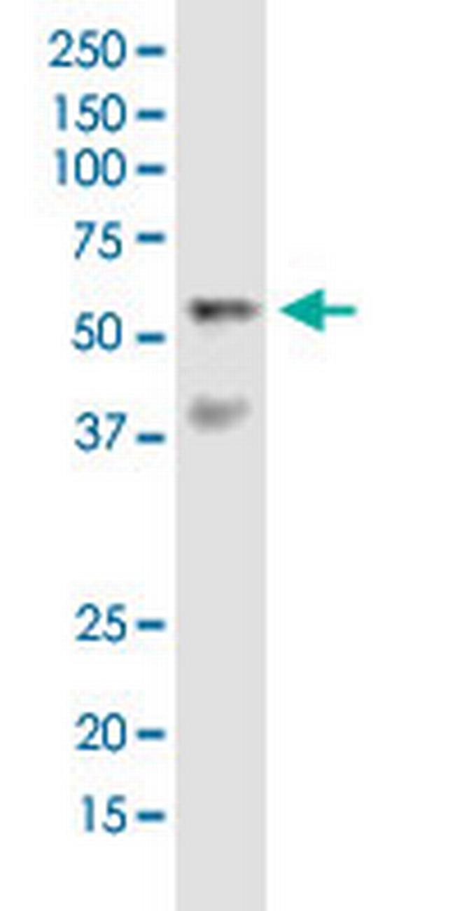 VRK2 Antibody in Western Blot (WB)