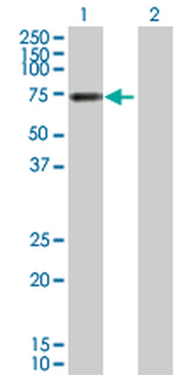 VTN Antibody in Western Blot (WB)