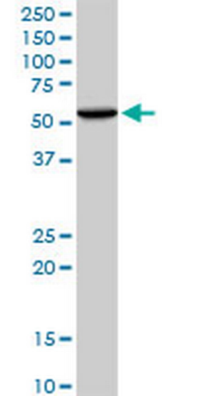 WARS Antibody in Western Blot (WB)