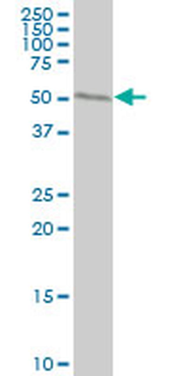 WARS Antibody in Western Blot (WB)