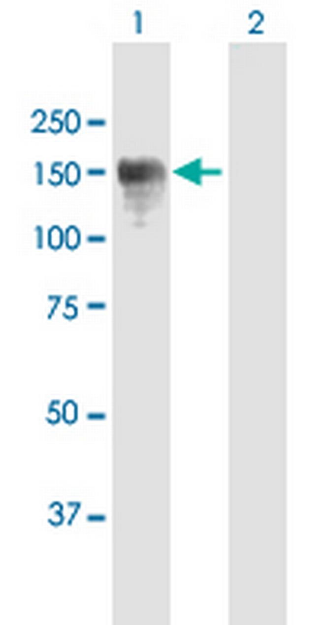 CLIP2 Antibody in Western Blot (WB)