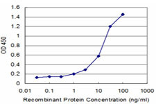 WRB Antibody in ELISA (ELISA)