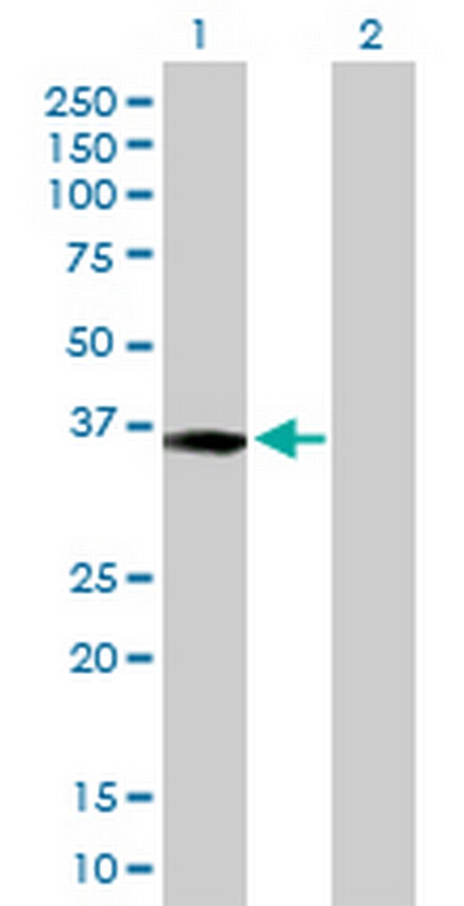 XPA Antibody in Western Blot (WB)