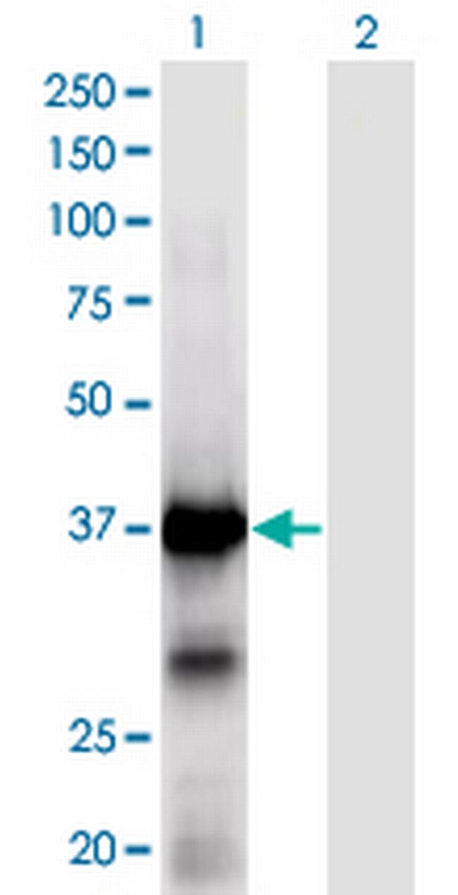 XPA Antibody in Western Blot (WB)