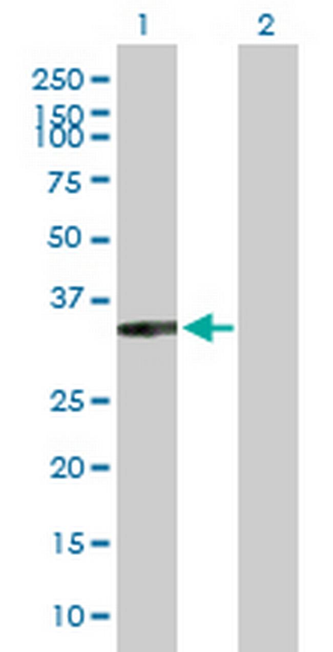 XRCC2 Antibody in Western Blot (WB)