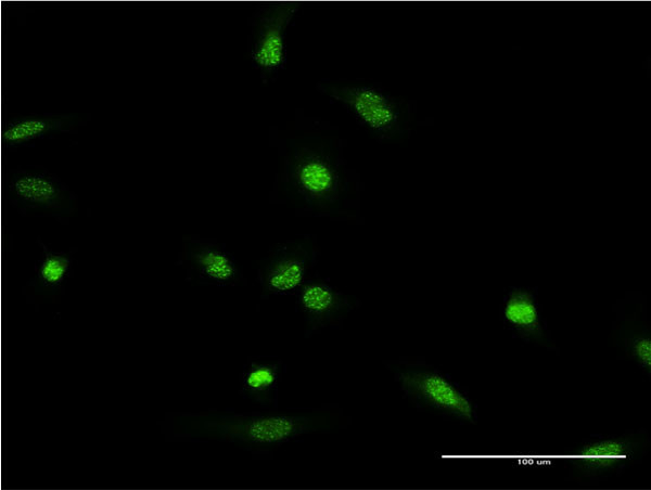 XRCC2 Antibody in Immunocytochemistry (ICC/IF)