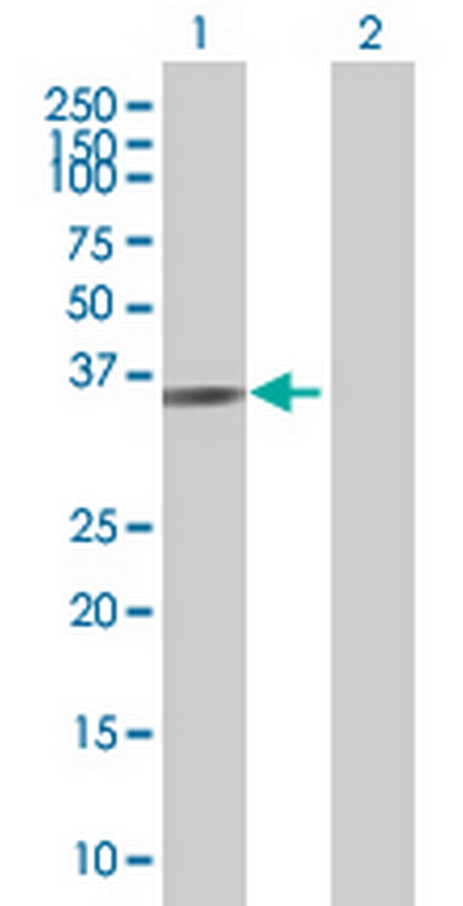 XRCC3 Antibody in Western Blot (WB)