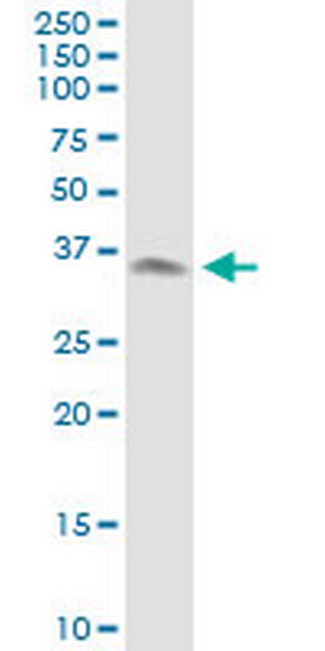 XRCC3 Antibody in Western Blot (WB)