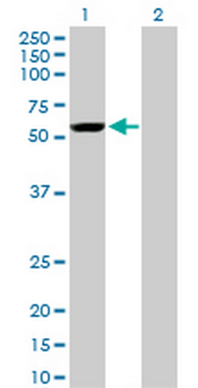 YES1 Antibody in Western Blot (WB)