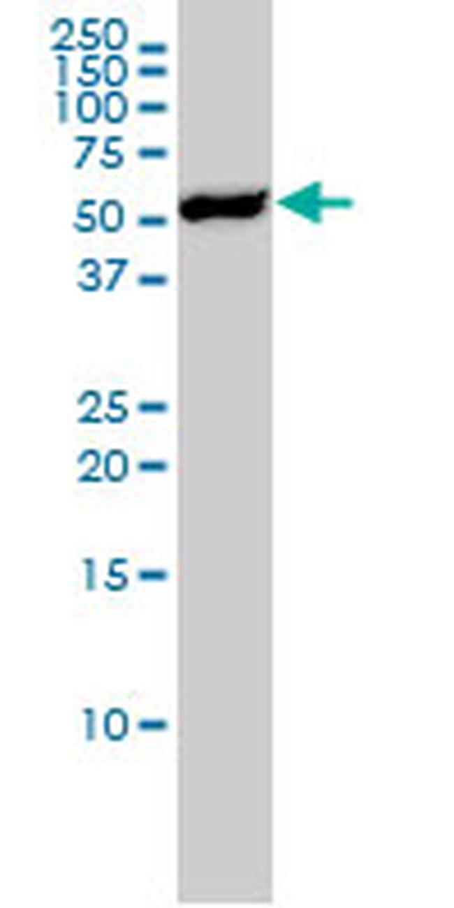 YES1 Antibody in Western Blot (WB)