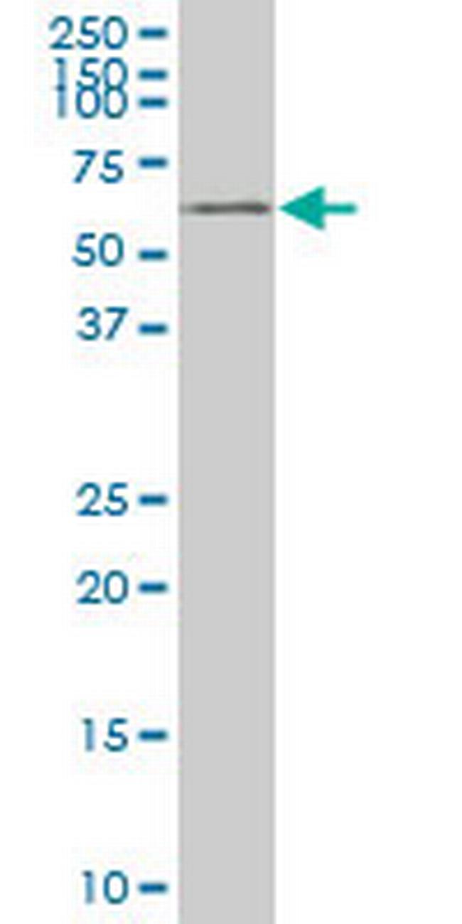 YES1 Antibody in Western Blot (WB)