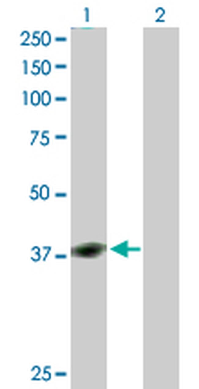 YY1 Antibody in Western Blot (WB)