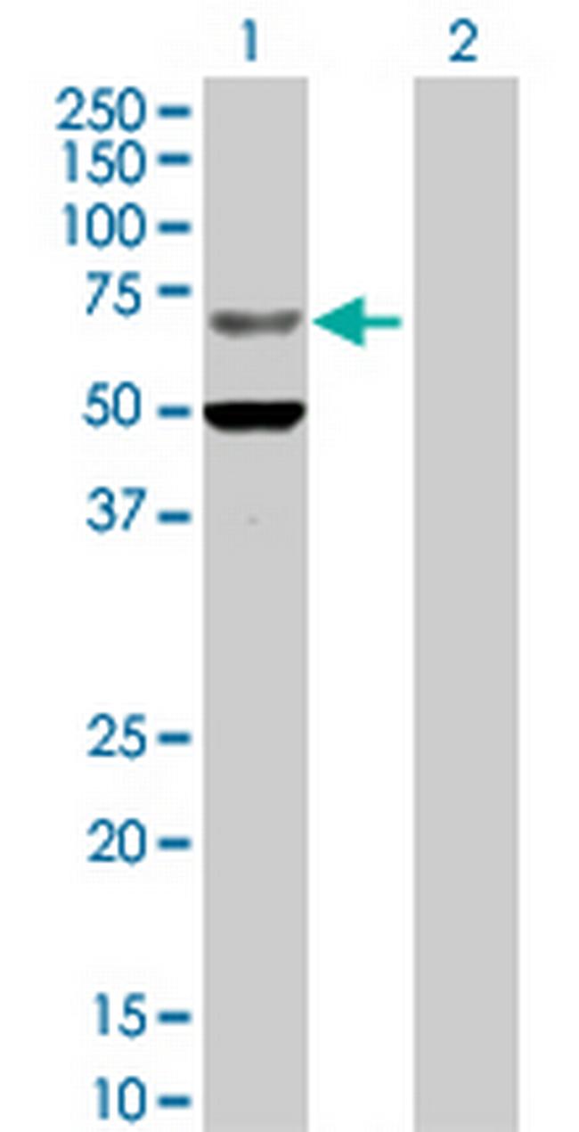 ZNF182 Antibody in Western Blot (WB)