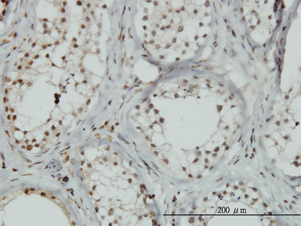 ZNF85 Antibody in Immunohistochemistry (Paraffin) (IHC (P))