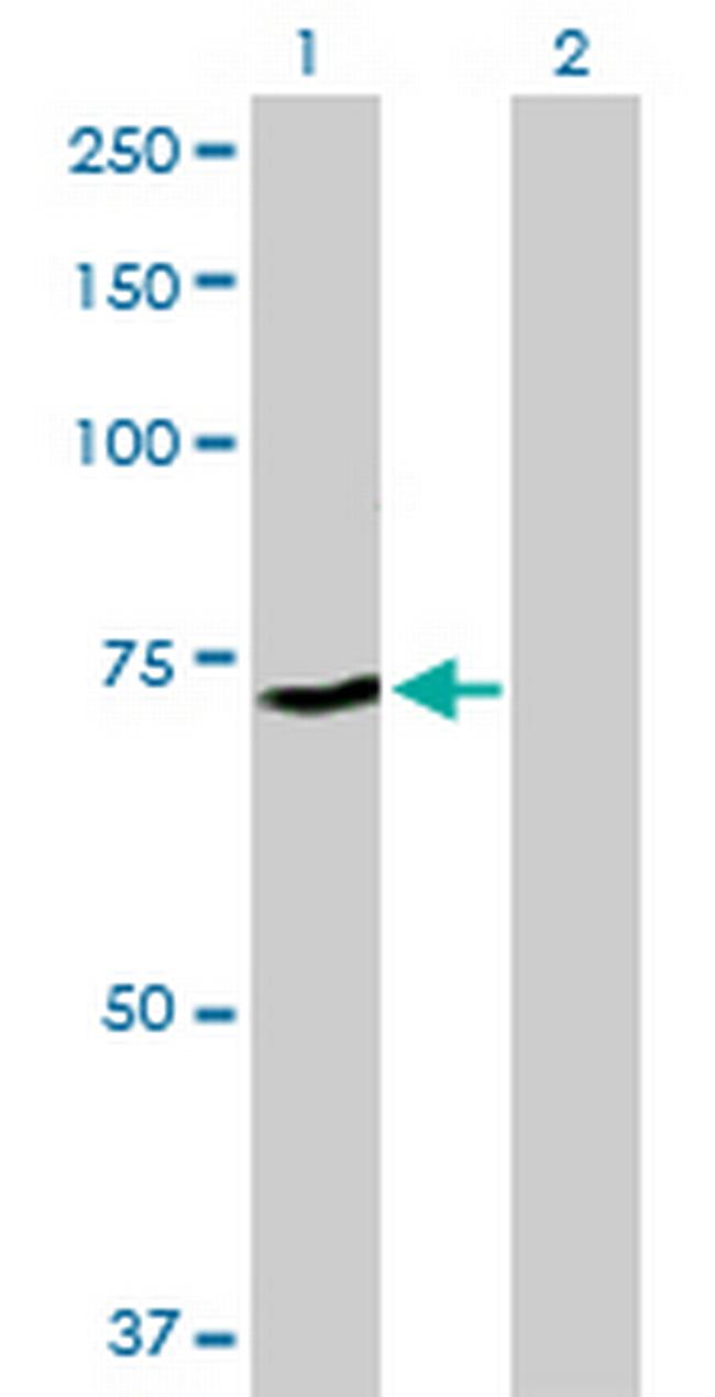 ZNF133 Antibody in Western Blot (WB)