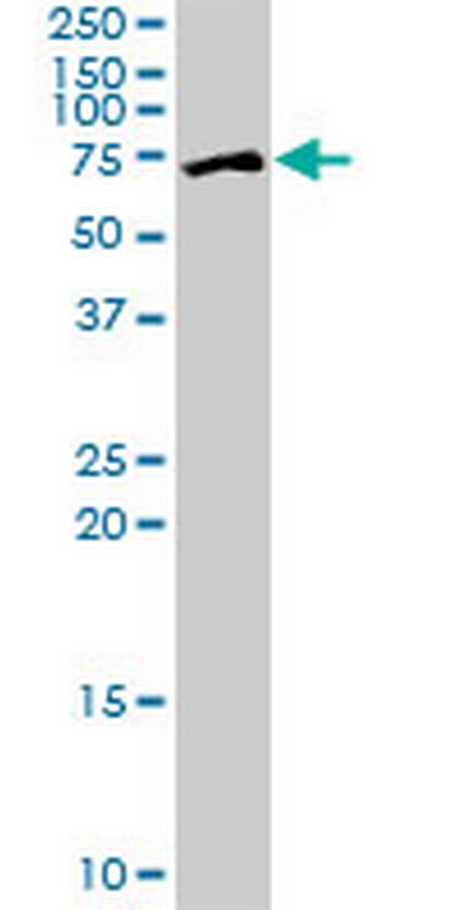 ZNF133 Antibody in Western Blot (WB)