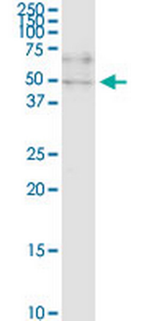 ZNF134 Antibody in Western Blot (WB)