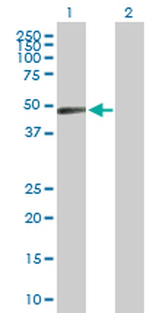 ZNF193 Antibody in Western Blot (WB)