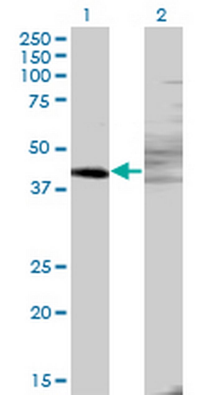 ZNF193 Antibody in Western Blot (WB)