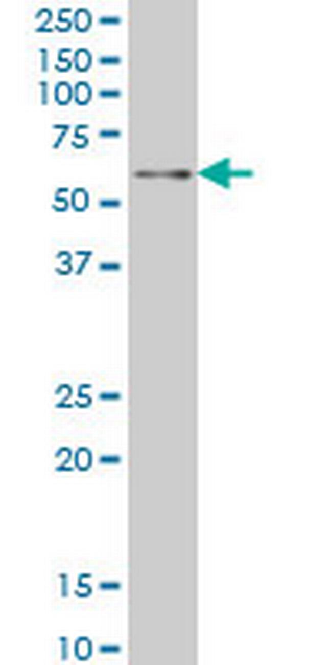 ZNF207 Antibody in Western Blot (WB)