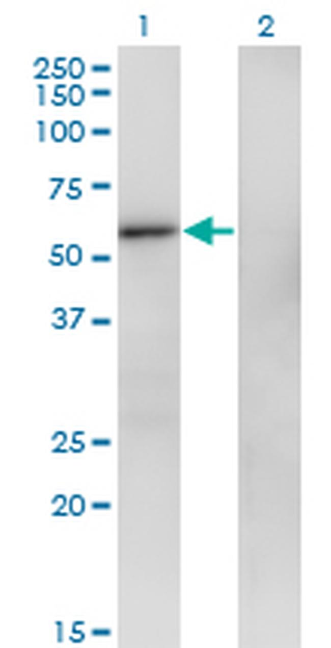 ZNF207 Antibody in Western Blot (WB)