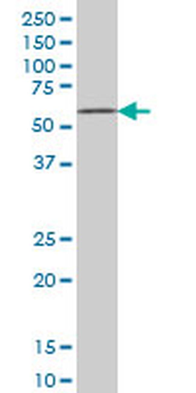 ZNF207 Antibody in Western Blot (WB)