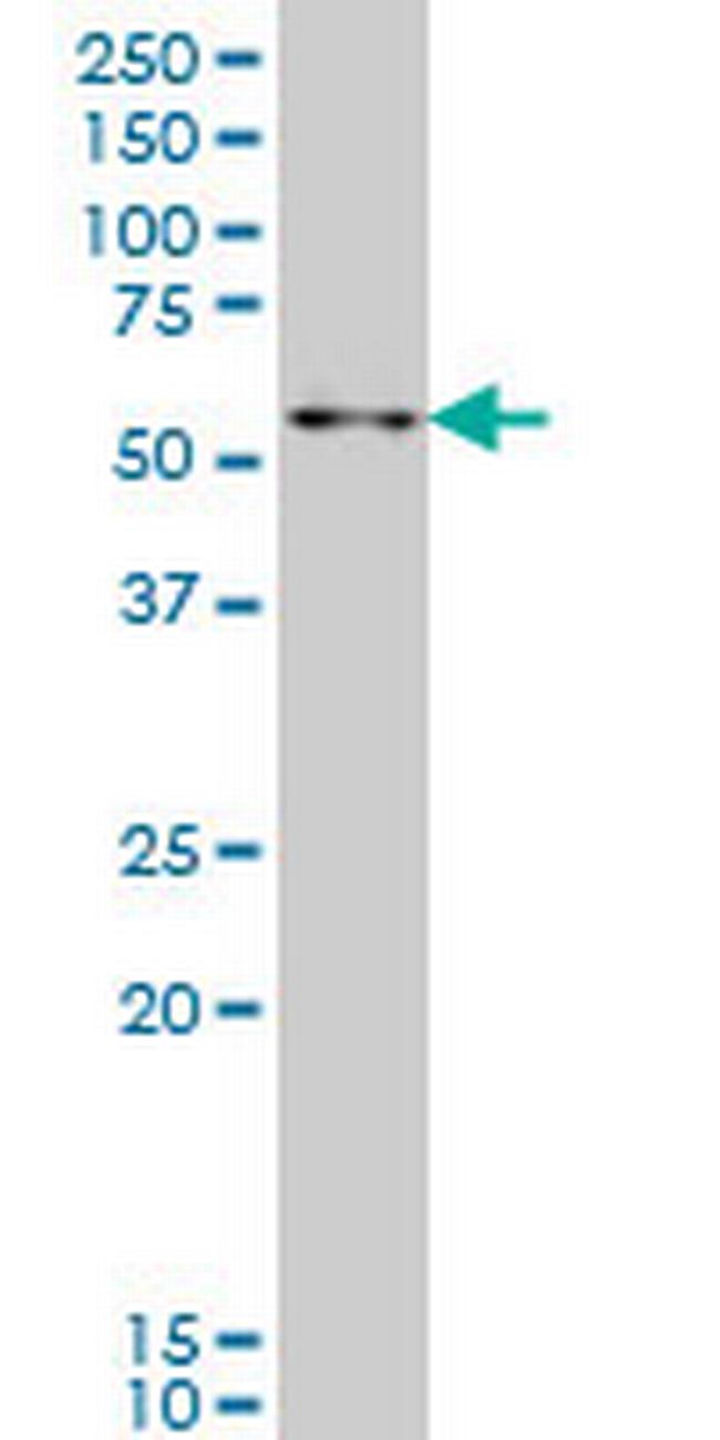 ZNF207 Antibody in Western Blot (WB)