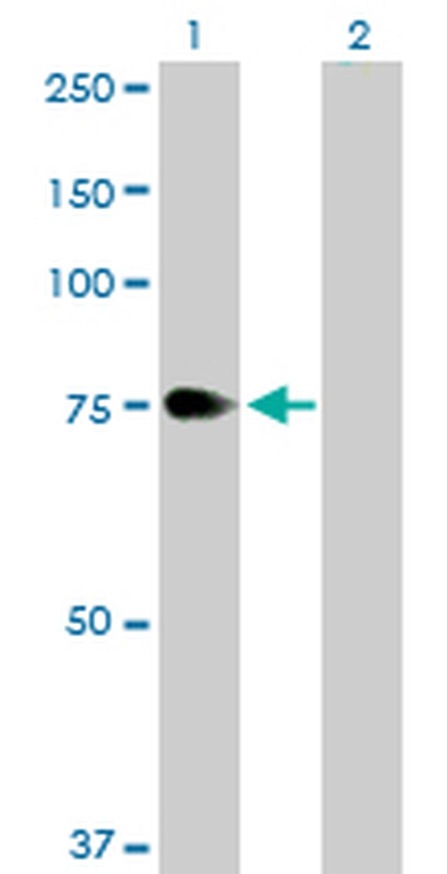 ZYX Antibody in Western Blot (WB)