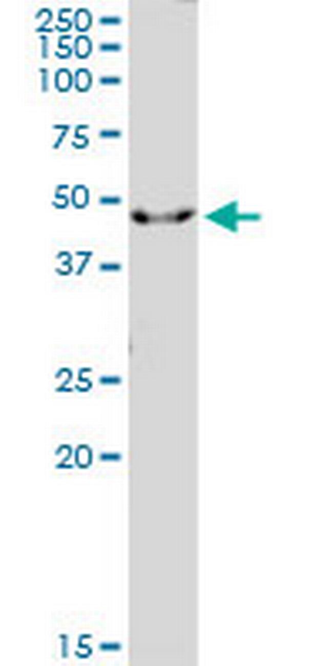 IL1R2 Antibody in Western Blot (WB)