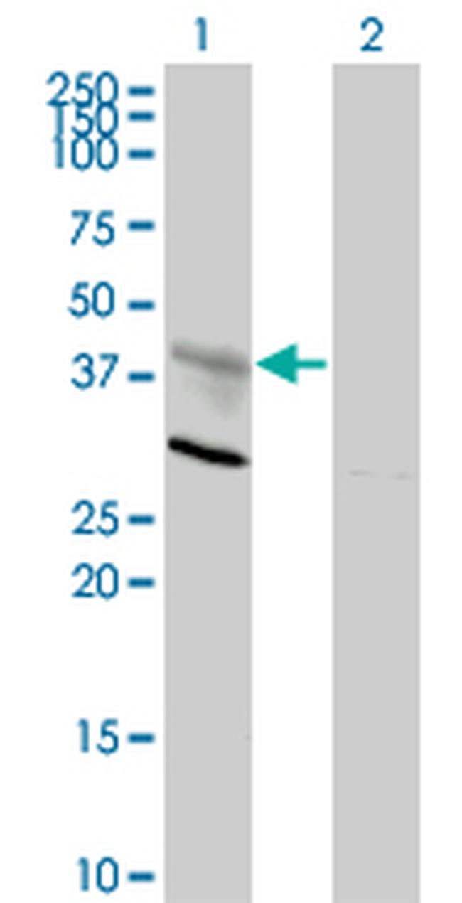 CXCR4 Antibody in Western Blot (WB)